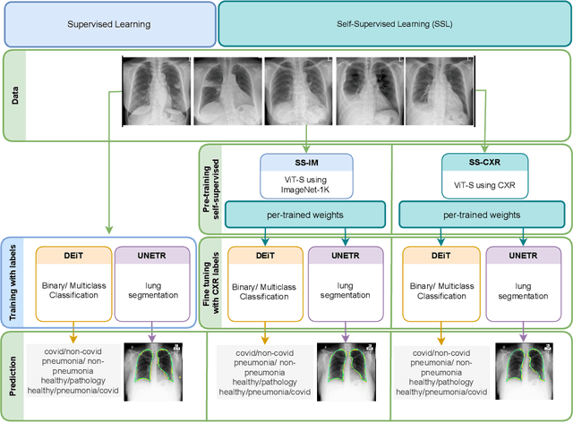 Figure 1 for SS-CXR: Multitask Representation Learning using Self Supervised Pre-training from Chest X-Rays