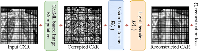 Figure 2 for SS-CXR: Multitask Representation Learning using Self Supervised Pre-training from Chest X-Rays