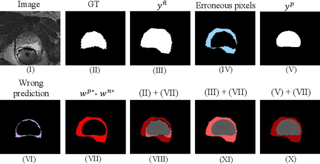 Figure 4 for Consistency-guided Meta-Learning for Bootstrapping Semi-Supervised Medical Image Segmentation