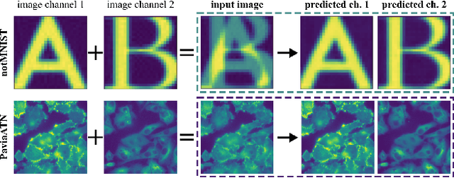 Figure 1 for μSplit: efficient image decomposition for microscopy data