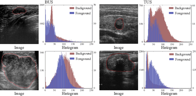 Figure 1 for Decomposing and Coupling Saliency Map for Lesion Segmentation in Ultrasound Images