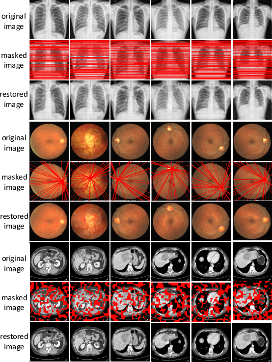 Figure 3 for A Knowledge-based Learning Framework for Self-supervised Pre-training Towards Enhanced Recognition of Medical Images