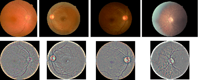 Figure 2 for Universal Adversarial Framework to Improve Adversarial Robustness for Diabetic Retinopathy Detection