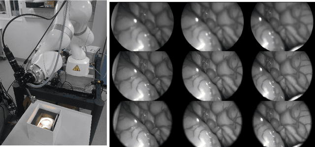 Figure 4 for Deep Reinforcement Learning Based System for Intraoperative Hyperspectral Video Autofocusing