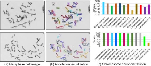Figure 3 for AutoKary2022: A Large-Scale Densely Annotated Dateset for Chromosome Instance Segmentation