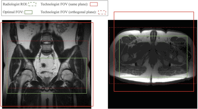 Figure 1 for Automated MRI Field of View Prescription from Region of Interest Prediction by Intra-stack Attention Neural Network