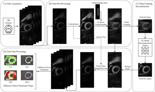 Figure 1 for Deep Learning-based Diffusion Tensor Cardiac Magnetic Resonance Reconstruction: A Comparison Study