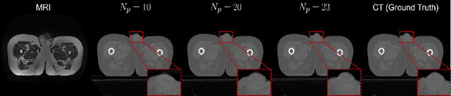 Figure 4 for DDMM-Synth: A Denoising Diffusion Model for Cross-modal Medical Image Synthesis with Sparse-view Measurement Embedding