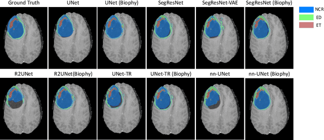 Figure 4 for Biophysics Informed Pathological Regularisation for Brain Tumour Segmentation
