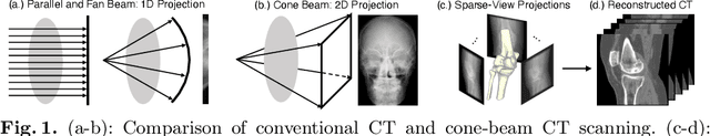 Figure 1 for Learning Deep Intensity Field for Extremely Sparse-View CBCT Reconstruction