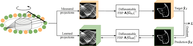 Figure 1 for Geometric Constraints Enable Self-Supervised Sinogram Inpainting in Sparse-View Tomography
