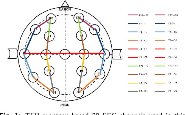 Figure 2 for MP-SeizNet: A Multi-Path CNN Bi-LSTM Network for Seizure-Type Classification Using EEG