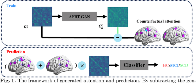 Figure 1 for AFBT GAN: enhanced explainability and diagnostic performance for cognitive decline by counterfactual generative adversarial network