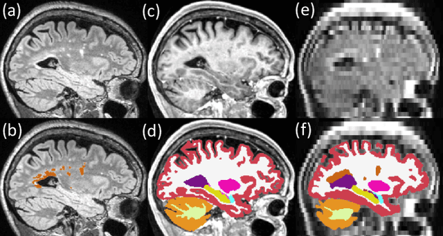 Figure 3 for Quantifying white matter hyperintensity and brain volumes in heterogeneous clinical and low-field portable MRI