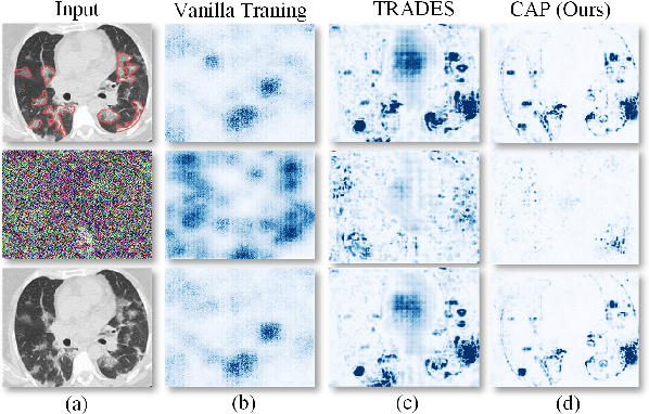 Figure 1 for Toward Robust Diagnosis: A Contour Attention Preserving Adversarial Defense for COVID-19 Detection