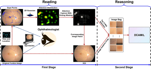 Figure 1 for Eye tracking guided deep multiple instance learning with dual cross-attention for fundus disease detection
