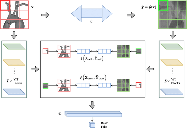 Figure 3 for Translating Simulation Images to X-ray Images via Multi-Scale Semantic Matching