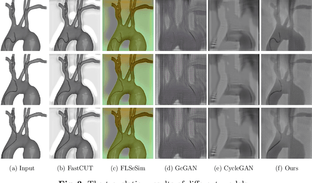 Figure 4 for Translating Simulation Images to X-ray Images via Multi-Scale Semantic Matching