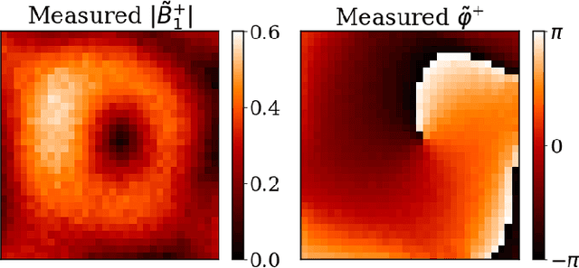 Figure 3 for PIFON-EPT: MR-Based Electrical Property Tomography Using Physics-Informed Fourier Networks