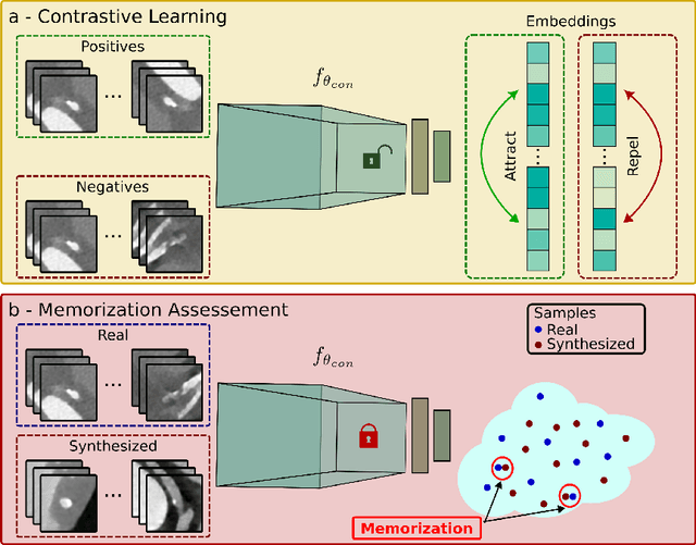 Figure 2 for Investigating Data Memorization in 3D Latent Diffusion Models for Medical Image Synthesis