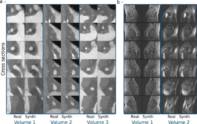 Figure 4 for Investigating Data Memorization in 3D Latent Diffusion Models for Medical Image Synthesis