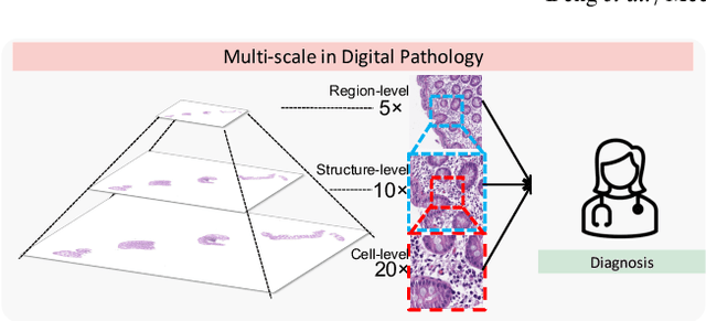 Figure 1 for Cross-scale Multi-instance Learning for Pathological Image Diagnosis