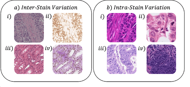 Figure 1 for Stain Consistency Learning: Handling Stain Variation for Automatic Digital Pathology Segmentation