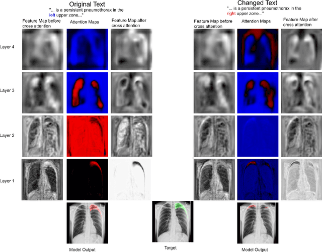 Figure 4 for ConTEXTual Net: A Multimodal Vision-Language Model for Segmentation of Pneumothorax