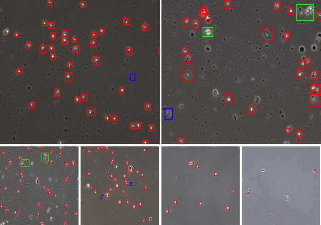Figure 2 for VISEM-Tracking: Human Spermatozoa Tracking Dataset