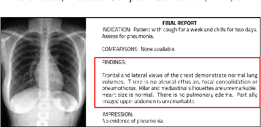 Figure 1 for Generation of Radiology Findings in Chest X-Ray by Leveraging Collaborative Knowledge