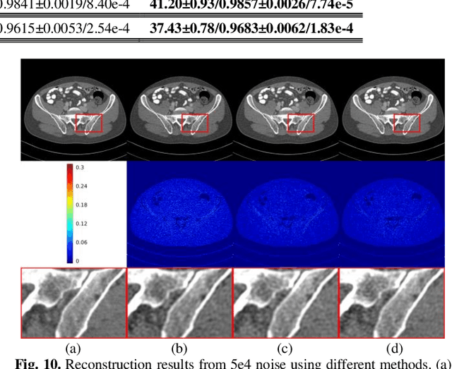 Figure 2 for One Sample Diffusion Model in Projection Domain for Low-Dose CT Imaging