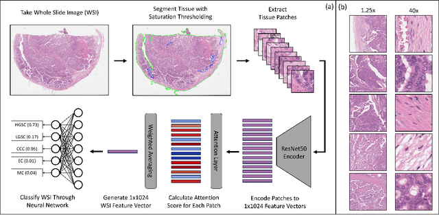 Figure 2 for Reducing Histopathology Slide Magnification Improves the Accuracy and Speed of Ovarian Cancer Subtyping