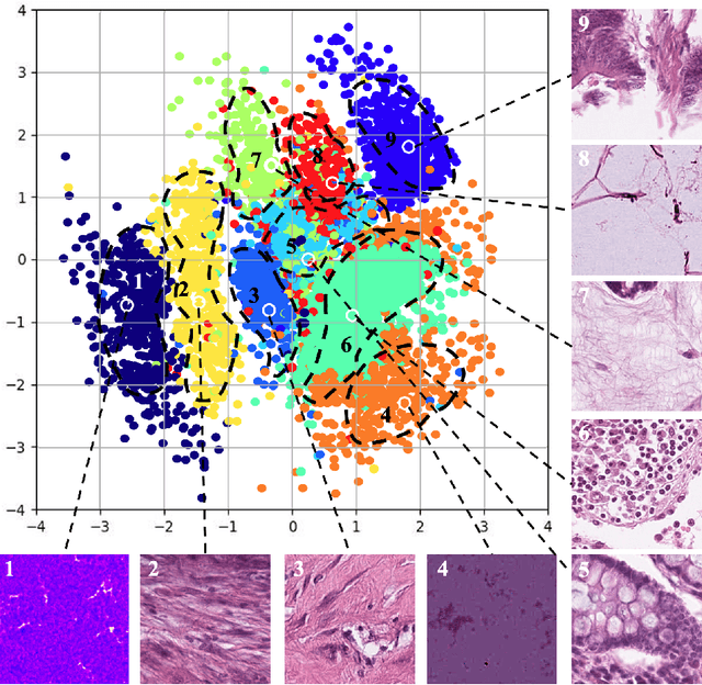 Figure 3 for Efficient Annotation for Medical Image Analysis: A One-Pass Selective Annotation Approach