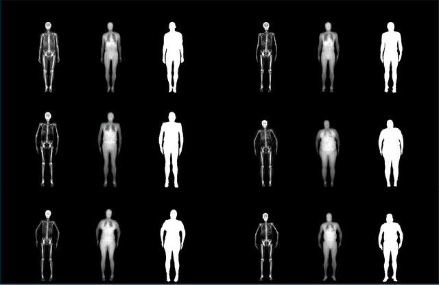 Figure 1 for MaSkel: A Model for Human Whole-body X-rays Generation from Human Masking Images