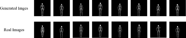 Figure 4 for MaSkel: A Model for Human Whole-body X-rays Generation from Human Masking Images