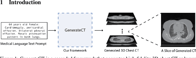 Figure 1 for GenerateCT: Text-Guided 3D Chest CT Generation