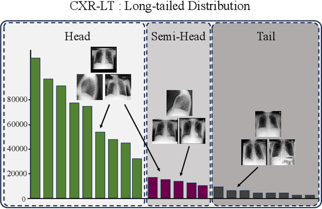 Figure 1 for Robust Asymmetric Loss for Multi-Label Long-Tailed Learning