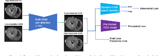 Figure 1 for High-Resolution Reference Image Assisted Volumetric Super-Resolution of Cardiac Diffusion Weighted Imaging