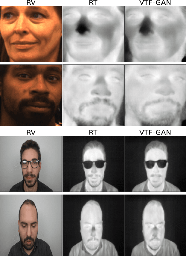 Figure 1 for When Visible-to-Thermal Facial GAN Beats Conditional Diffusion