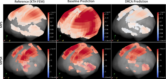 Figure 3 for Toward more accurate and generalizable brain deformation estimators for traumatic brain injury detection with unsupervised domain adaptation
