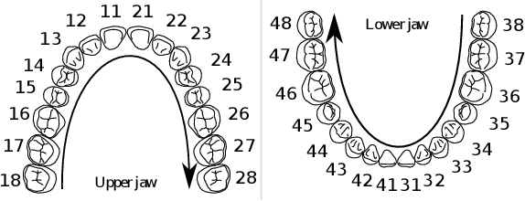 Figure 2 for 3DTeethSeg'22: 3D Teeth Scan Segmentation and Labeling Challenge