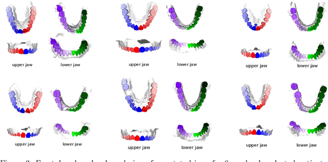 Figure 4 for 3DTeethSeg'22: 3D Teeth Scan Segmentation and Labeling Challenge