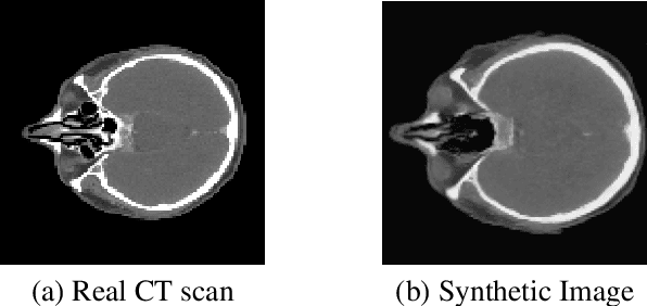 Figure 4 for Paired Diffusion: Generation of related, synthetic PET-CT-Segmentation scans using Linked Denoising Diffusion Probabilistic Models