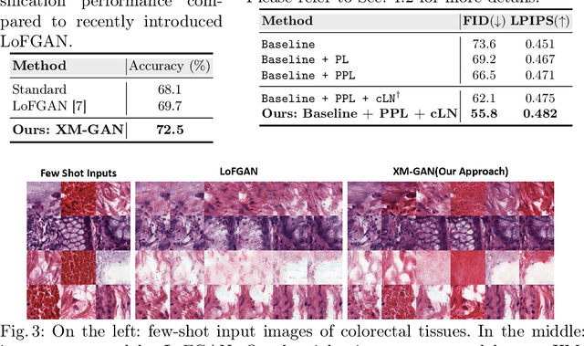 Figure 3 for Cross-modulated Few-shot Image Generation for Colorectal Tissue Classification