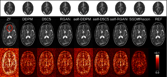 Figure 3 for Self-Supervised MRI Reconstruction with Unrolled Diffusion Models