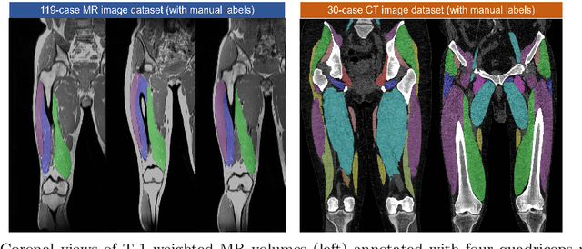 Figure 1 for Hybrid Representation-Enhanced Sampling for Bayesian Active Learning in Musculoskeletal Segmentation of Lower Extremities