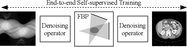 Figure 1 for On the Benefit of Dual-domain Denoising in a Self-supervised Low-dose CT Setting