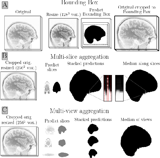 Figure 3 for Deepbet: Fast brain extraction of T1-weighted MRI using Convolutional Neural Networks