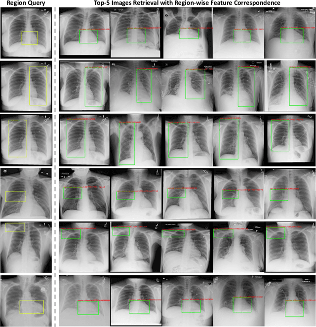 Figure 3 for Region-based Contrastive Pretraining for Medical Image Retrieval with Anatomic Query