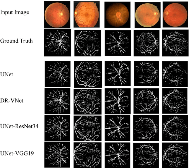 Figure 2 for Segmentation of Retinal Blood Vessels Using Deep Learning